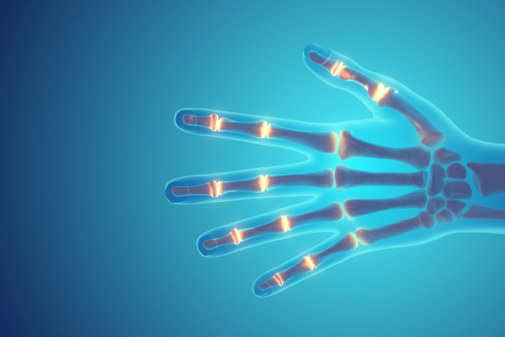 વા, સંધિવા તથા ગઠીયા એટલે શું? તેના&nbsp;ઉપાયો.